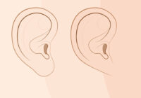 What Causes Swollen Earlobes?